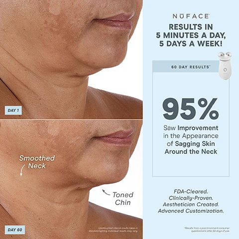 Image 1, results in 5 minutes a day, 5 days a week. day 1 and day 60 - smoothed neck and toned chin. unretouched clinical results taken in standard lighting, individual results may vary. 60 day results - 95% saw improvement in the appearance of sagging skin around the neck. FDA cleared, clinically proven, aesthetician created, advanced customisation. results from a post treatment consumer questionnaire after 60 days of use. image 2, 1 device, 3 attachments, endless treatments. built in sensor = ensures consistent microcurrent intensity for all skin types. effective lip and eye attachment - lifts and tightens hard to reach areas around mouth and eyes. energizing hum. built in sensor automatically turns on when placed on skin. wrinkles reducer attachment - helps reduce full face wrinkles with a combination of red, amber and infrared lights. smart technology perfect for = advanced customisation. FDA cleared, clinically proven, aesthetician created. unlock exclusive treatments. bluetooth enabled. pair with the nuface smart app. image 3, targeted results. lift the brow, lift lips and smile lines. tighten skin around the eyes. image 4, results in 5 minutes a day, 5 days a week. day 1 and day 60 - lifted brow. unretouched clinical results taken in standard lighting, individual results may vary. 60 day results - 80% saw a lifted brow and awakened eye. FDA cleared, clinically proven, aesthetician created, advanced customisation. results from a post treatment consumer questionnaire after 60 days of use. image 4, targeted results. lift the brow, lift lips and smile lines. tighten skin around the eyes. image 4, results in 5 minutes a day, 5 days a week. day 1 and day 60 - reduced smile line. unretouched clinical results taken in standard lighting, individual results may vary. 60 day results - 78% saw an improvement in smile lines. FDA cleared, clinically proven, aesthetician created, advanced customisation. results from a post treatment consumer questionnaire after 60 days of use. image 5, 1 device, endless customisable results. instant results that build with consistent use. contour cheeks. lift eyes and brows. tone jowls and jawline. smooth neck and forehead. lift lips and smile lines. image 6, results in 5 minutes a day, 5 days a week. day 1 and day 60 - reduced deep lines. unretouched clinical results taken in standard lighting, individual results may vary. 60 day results - 93% saw reduction in the appearance of deep lines. FDA cleared, clinically proven, aesthetician created, advanced customisation. results from a post treatment consumer questionnaire after 60 days of use. image 7, microcurrent 101 = a low level electrical current that mimics and re-energizes the body's natural current to tone, lift and contour down to the muscles. skincare is your nutrition, micro current is your fitness. trinity+ is fitness for your face. image 8, unlock app exclusive treatments to target different layers of skin and muscles. help reduce wrinkles and plump skin skin tightening mode. helps instantly lift and contour instant lift mode. long term muscle sculpting pro toning mode. after 15 minutes of use. after 14 days of use. unlocked with nuFACE app. image 9, smart app. follow step by step tutorials. track progress. customise results with app exclusive treatments. set treatment reminders. image 10, comparison of three nuface devices. trinity+ advanced customisation. unlock app exclusive treatments - yes. boost with 25% microcurrent - yes. nuface smart app - yes. attachment options (eye and lip attachment and LEF red light attachment sold separately - yes. microcurrent treatment areas - jowls and jawline, neck, cheeks and forehead, around eyes and brows, around mouth and lips, smile lines. mini+ on the go lifting. unlock app exclusive treatments - yes. boost with 25% microcurrent - no. nuface smart app - yes. attachment options (eye and lip attachment and LED red light attachment sold separately - no. microcurrent treatment areas - jowls and jawline, neck, cheeks and forehead. fix, instant finisher.